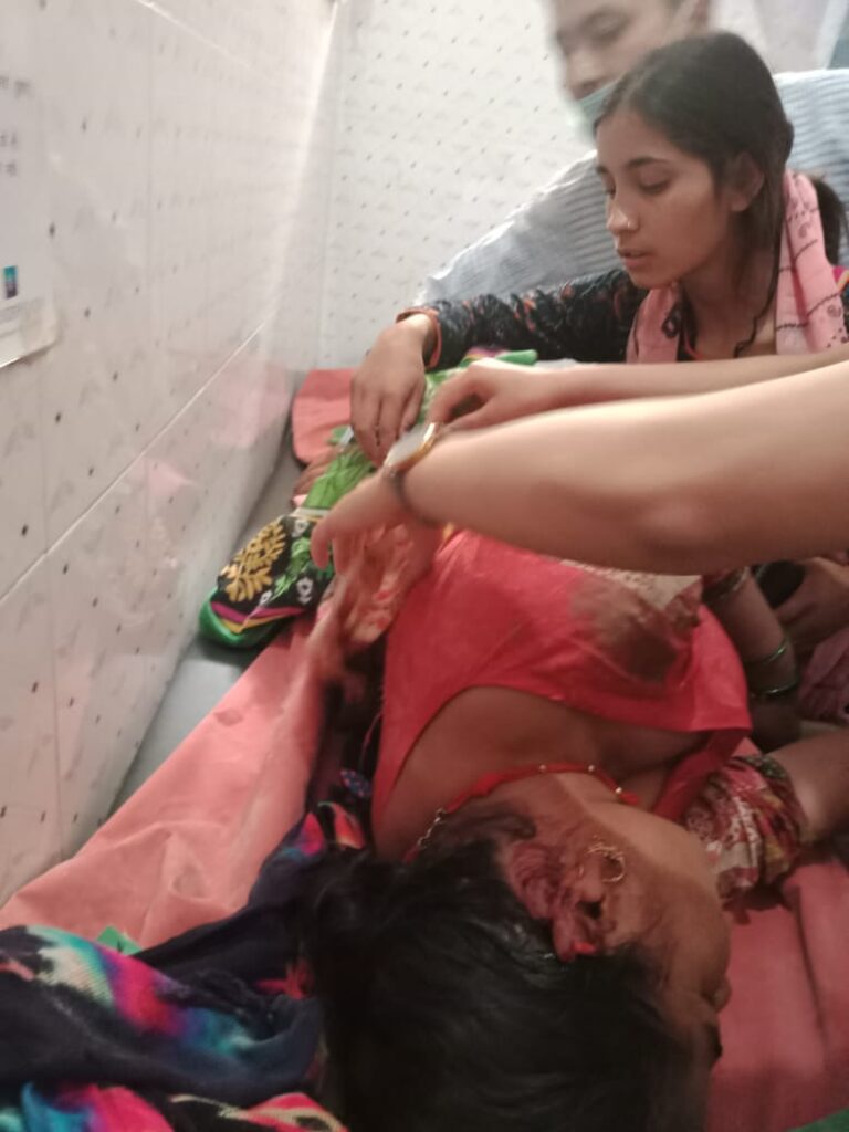 भालू ने महिला पर हमला कर किया घायल