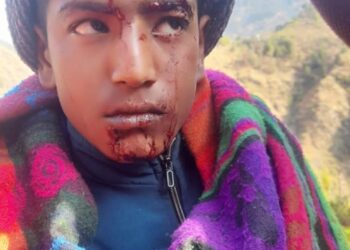 परीक्षा देने जा रहे 15 साल के छात्र पर गुलदार का हामला , युवक गंभीर रुप से घायल