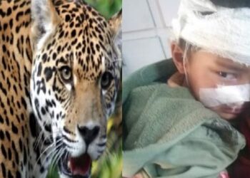 Uttarakhand: पांच साल के बच्चे पर गुलदार का जानलेवा हमला, सिर से पैर तक गहरे घाव